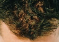 Paul Stokes after