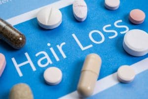 Hair Loss Tablets