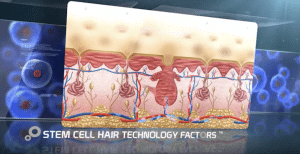 Stem Cell Treatment United Kingdom