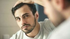 A Guide to the Most Common Hair Loss Conditions