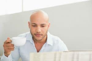 Signs Of Going Bald