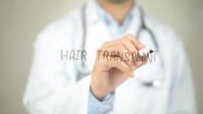 The-FUE-Hair-Transplant-Cost-That-Anyone-Can-Afford-300x169