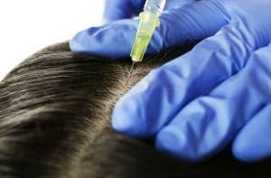 Want-the-Best-FUE-Hair-Transplant-in-Sydney-300x197