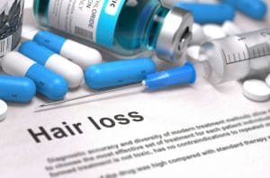 Minoxidil Reviews and Results