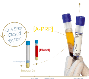 PRP System for Optimal Platelet Recovery