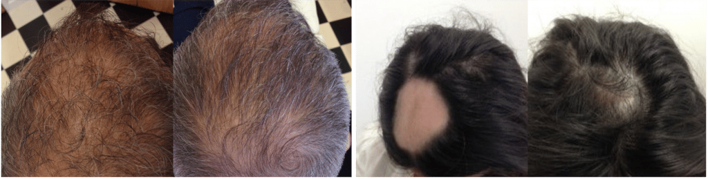 Proven results