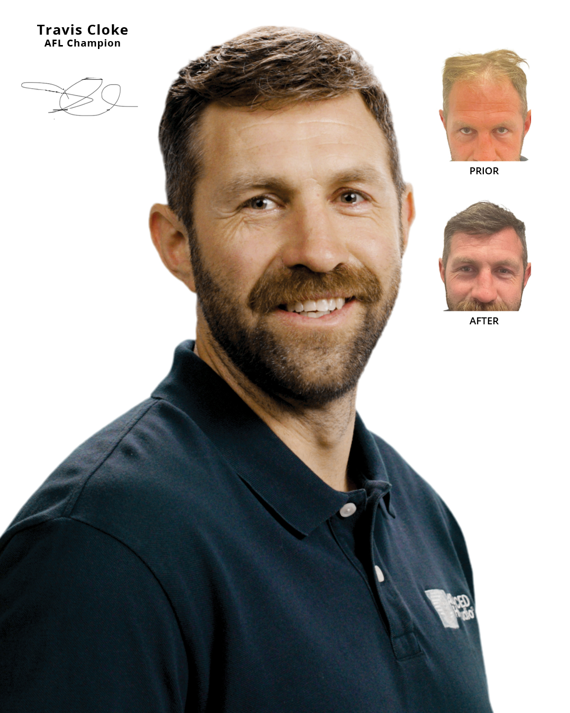 Ahs Travis Cloke Png