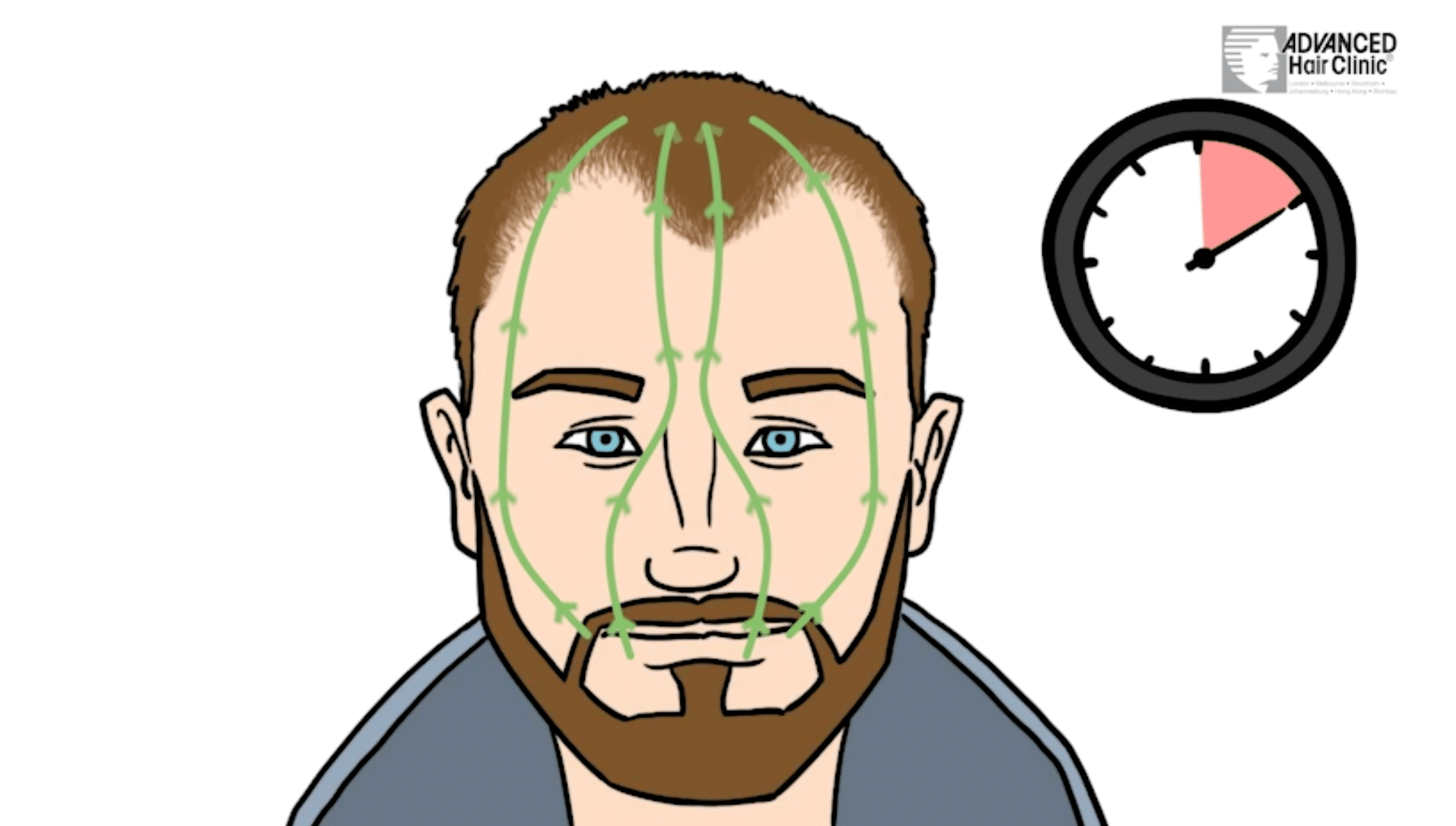 Advanced Follicle Direct Png