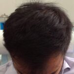 Prp 1 After Scaled 1 Jpg